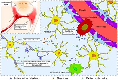 Secondary White Matter Injury and Therapeutic Targets After Subarachnoid Hemorrhage